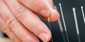 Doctor uses needles for treatment of the patient