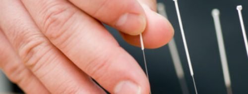 Doctor uses needles for treatment of the patient